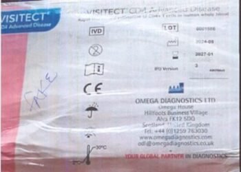 NAFDAC Warns Nigerians Over Fake HIV Test Kits